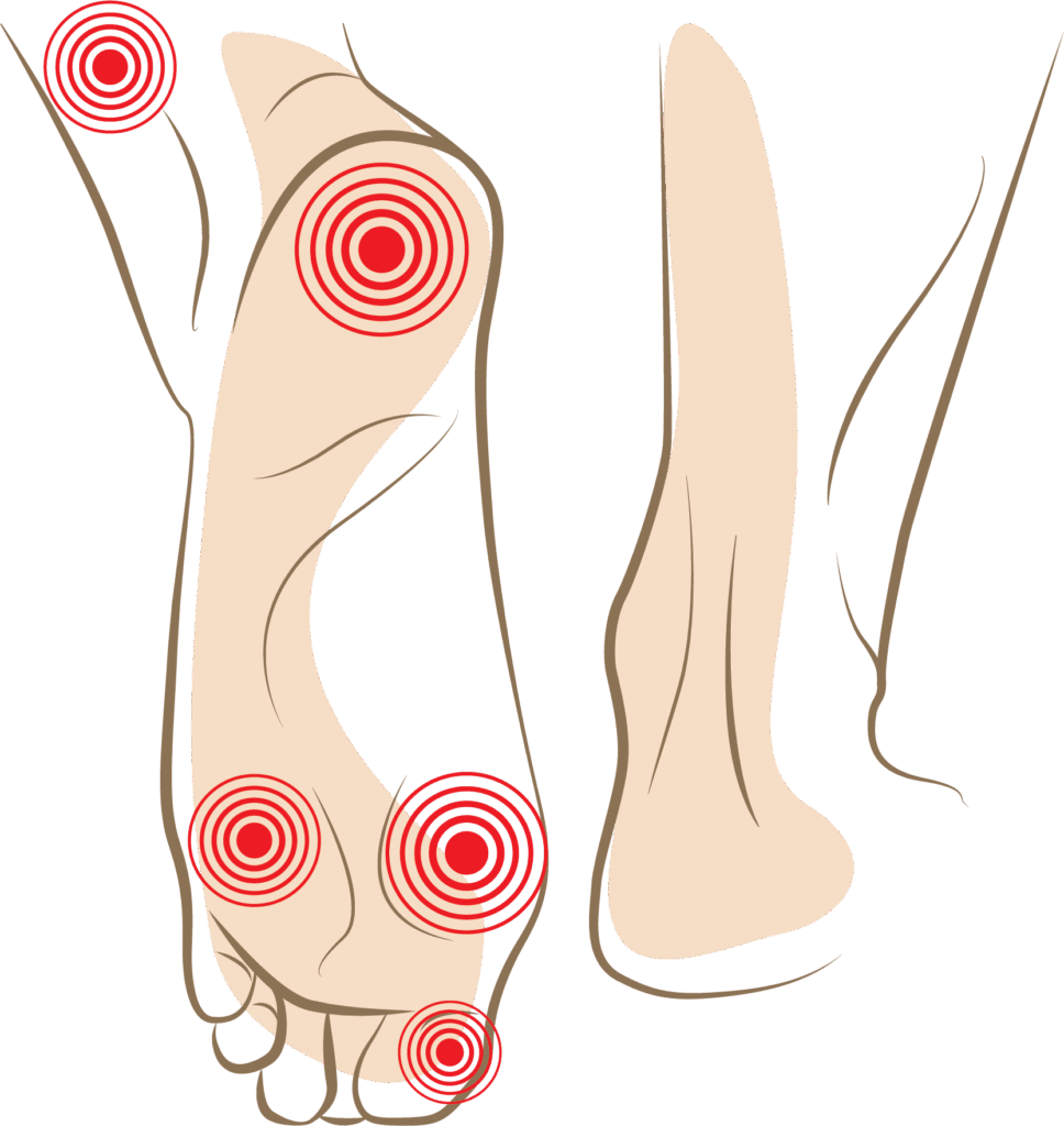 Diagram of important spots for foot mechanics — the heel, ball of the foot, toes, and ankle